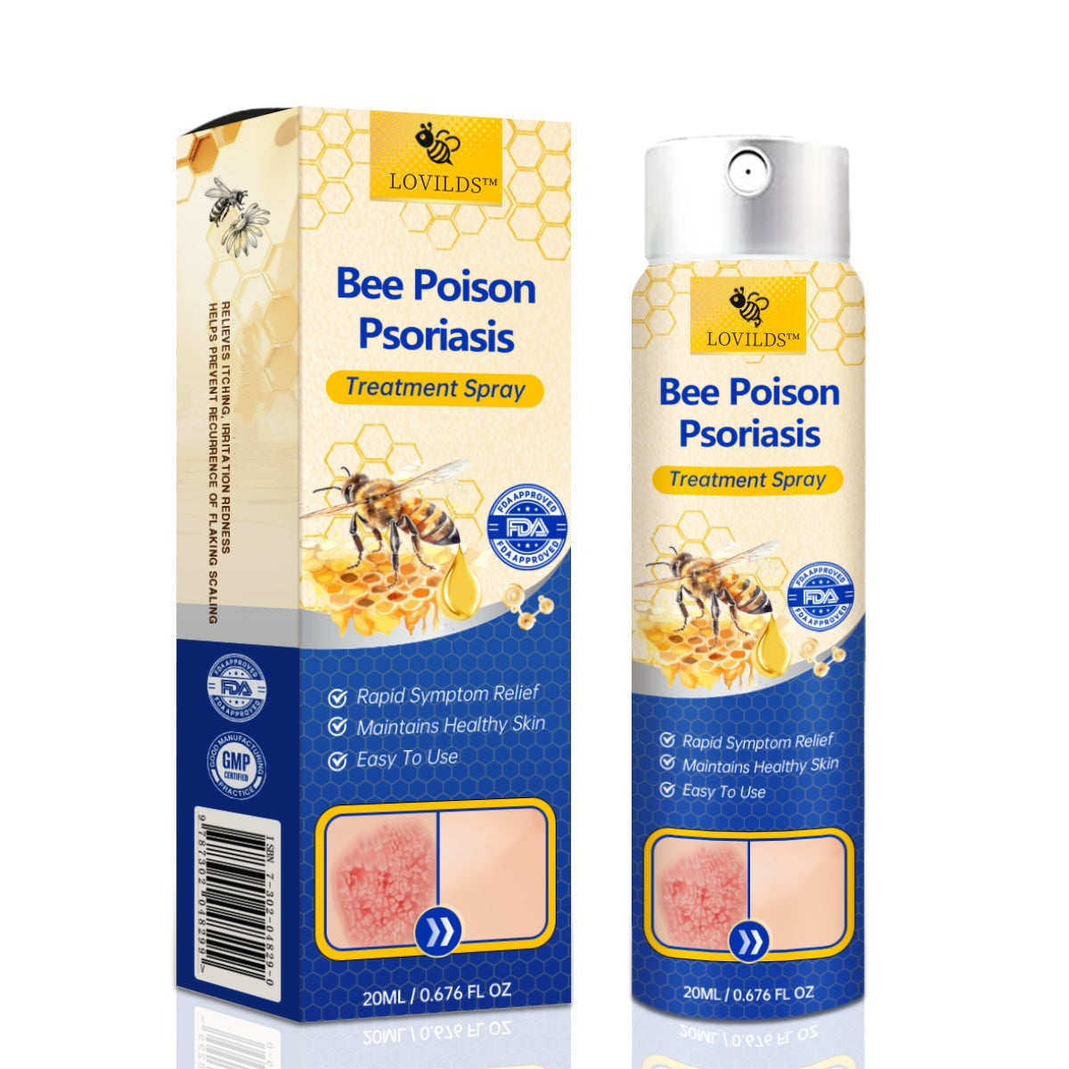✨【 official  Brand  Store】  Last Day Discount: 83% OFF 🌸 LOVILDS™ PsoriaHeal  psoriasis Spray pro