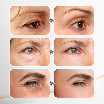 🌸Instant Temporary Face Tightener