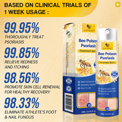 ✨【 official  Brand  Store】  Last Day Discount: 83% OFF 🌸 LOVILDS™ PsoriaHeal  psoriasis Spray pro