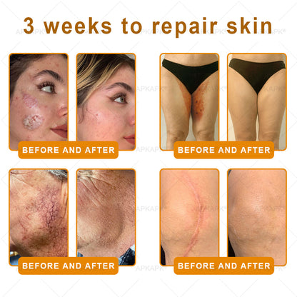 Made and Shipped from USA ✨ HZA® Bee venom Comprehensive Cream 🔥 LAST DAY 86% OFF 💎💎