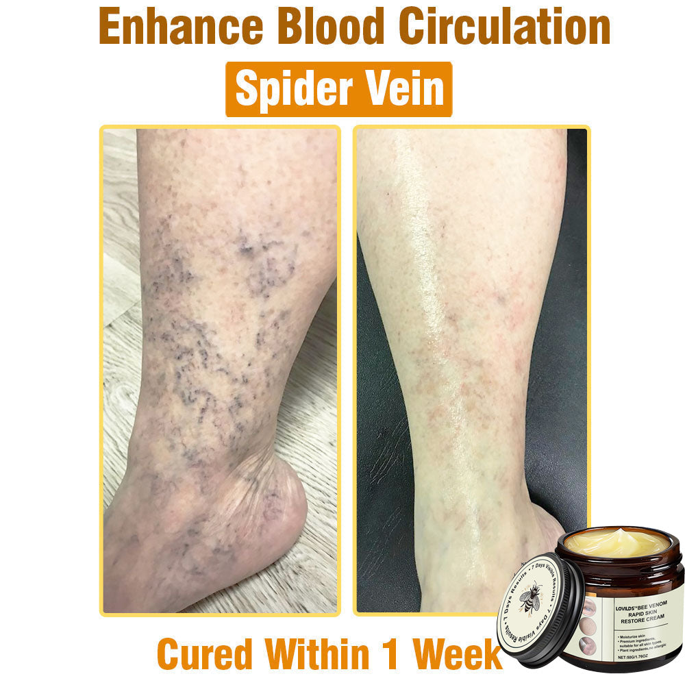 LOVILDS™ Bee Venom Total Skin Renewal Cream US Dermatologist Approved
