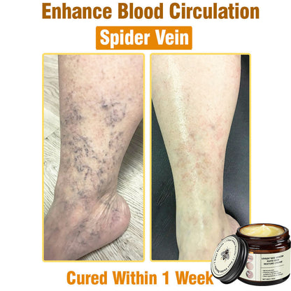 LOVILDS™ Bee Venom Total Skin Renewal Cream US Dermatologist Approved