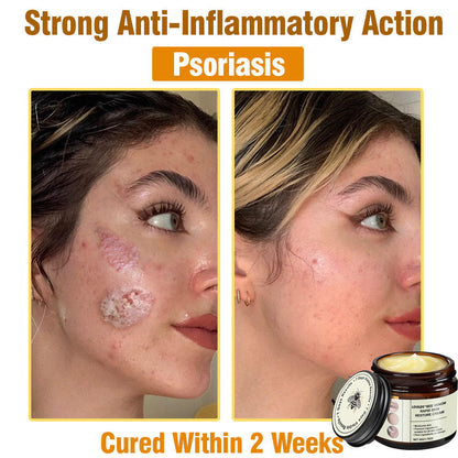 LOVILDS™ Bee Venom Total Skin Renewal Cream US Dermatologist Approved