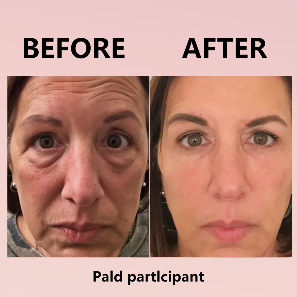 🌸Instant Temporary Face Tightener