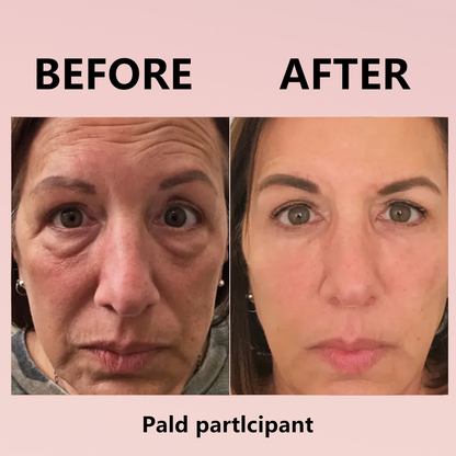 🌸Instant Temporary Face Tightener