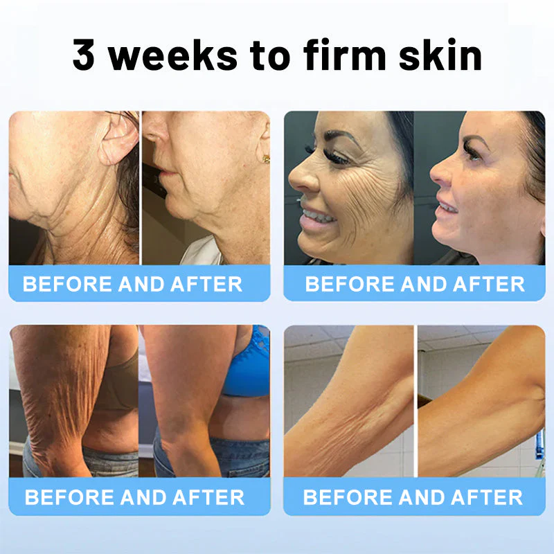 Final 3 Hours: 81% OFF🔥BBOJI® Anti Aging And Firming Cream
