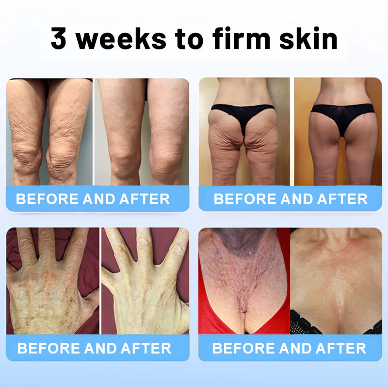 Final 3 Hours: 81% OFF🔥BBOJI® Anti Aging And Firming Cream