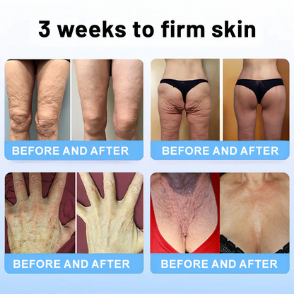 Final 3 Hours: 81% OFF🔥BBOJI® Anti Aging And Firming Cream