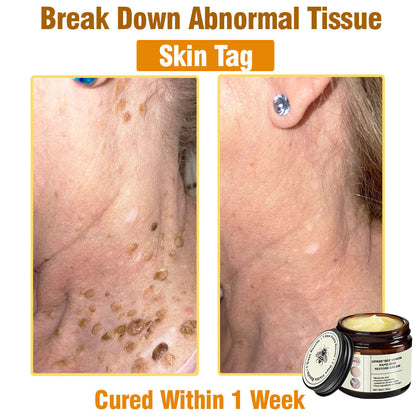 LOVILDS™ Bee Venom Total Skin Renewal Cream US Dermatologist Approved
