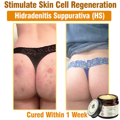 LOVILDS™ Bee Venom Total Skin Renewal Cream US Dermatologist Approved