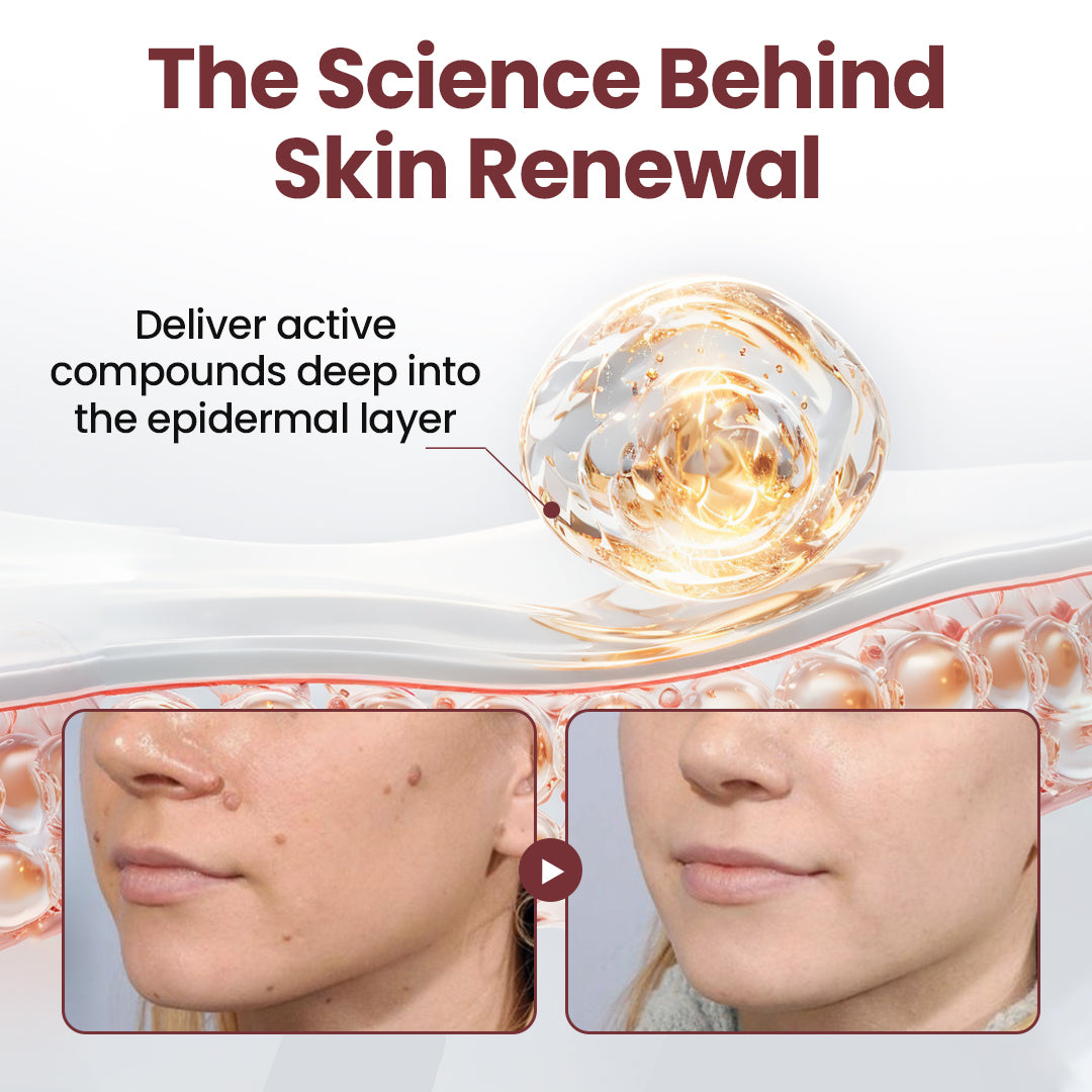 LOVILDS™KeraErase Dual-Action Renewal Cream1