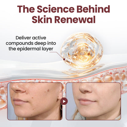 LOVILDS™KeraErase Dual-Action Renewal Cream1