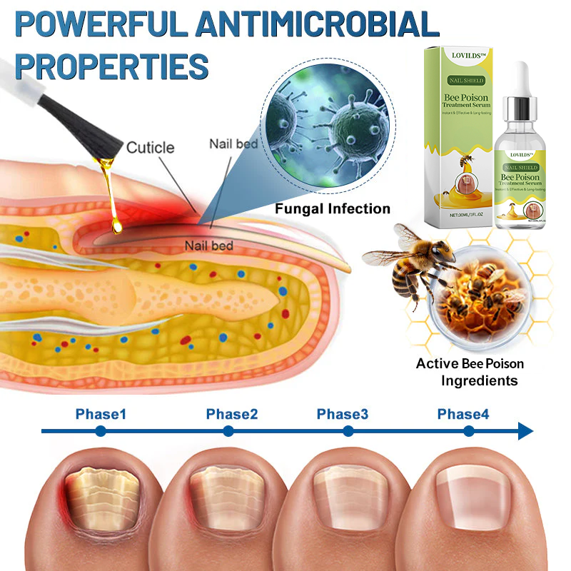 (🔥LAST DAY SALE-82% OFF) LOVILDS™ Nail Fungus Bee Poison Treatment Serum