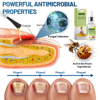 (🔥LAST DAY SALE-82% OFF) LOVILDS™ Nail Fungus Bee Poison Treatment Serum