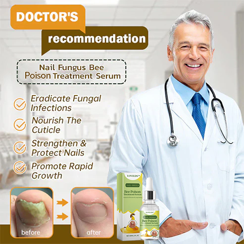 (🔥LAST DAY SALE-82% OFF) LOVILDS™ Nail Fungus Bee Poison Treatment Serum