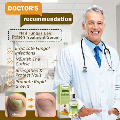 (🔥LAST DAY SALE-82% OFF) LOVILDS™ Nail Fungus Bee Poison Treatment Serum