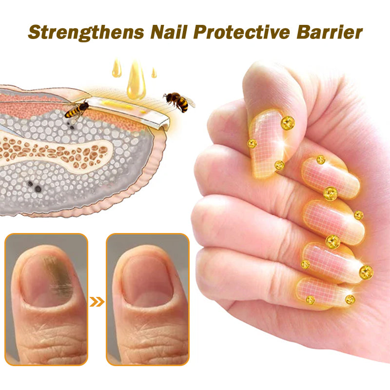 (🔥LAST DAY SALE-82% OFF) LOVILDS™ Nail Fungus Bee Poison Treatment Serum
