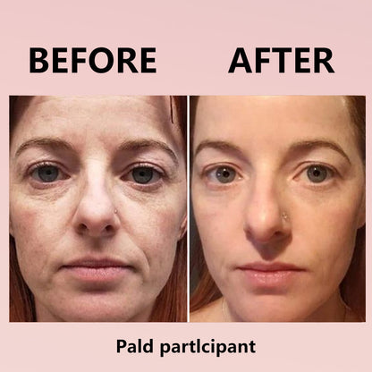 🌸Instant Temporary Face Tightener