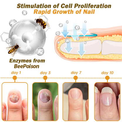 (🔥LAST DAY SALE-82% OFF) LOVILDS™ Nail Fungus Bee Poison Treatment Serum