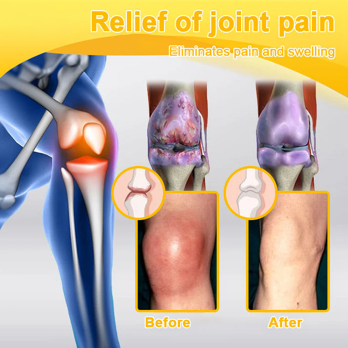 🐝AQA™ Botulinum & Bee Essence Pain-Relief Bone Healing Cream
