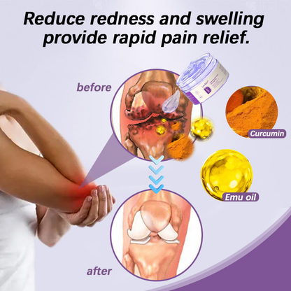 LOVILDS™ Turmeric & Emu Oil Arthritis Soothing Pain Relief Massage Gel 👨‍⚕️Australian Osteopathic Association （AOA）Approved