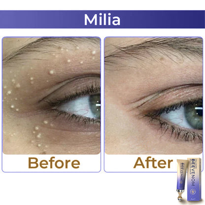 HZA  Collagen+ Bee Venom Roller Eye Cream 🇺🇸 Dermatologist Approved