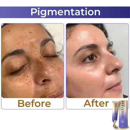 HZA  Collagen+ Bee Venom Roller Eye Cream 🇺🇸 Dermatologist Approved