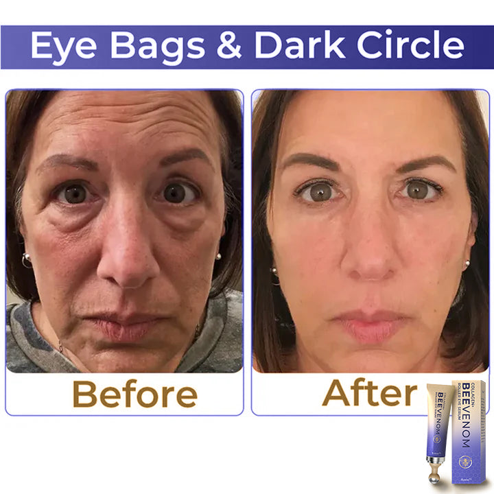 HZA  Collagen+ Bee Venom Roller Eye Cream 🇺🇸 Dermatologist Approved