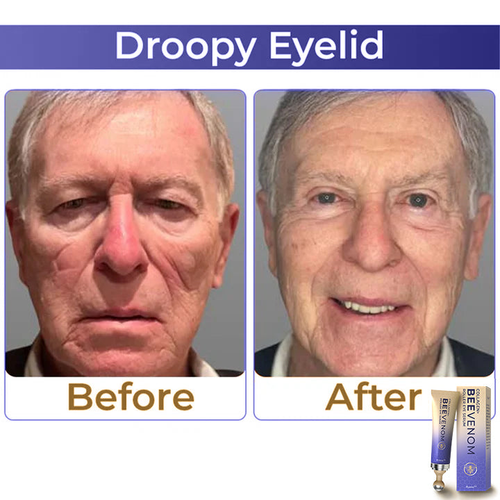HZA  Collagen+ Bee Venom Roller Eye Cream 🇺🇸 Dermatologist Approved