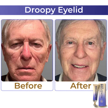 HZA  Collagen+ Bee Venom Roller Eye Cream 🇺🇸 Dermatologist Approved