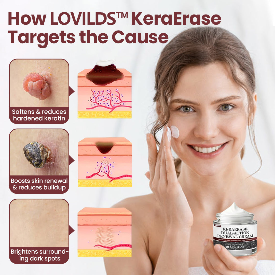 LOVILDS™KeraErase Dual-Action Renewal Cream