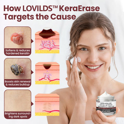 LOVILDS™KeraErase Dual-Action Renewal Cream