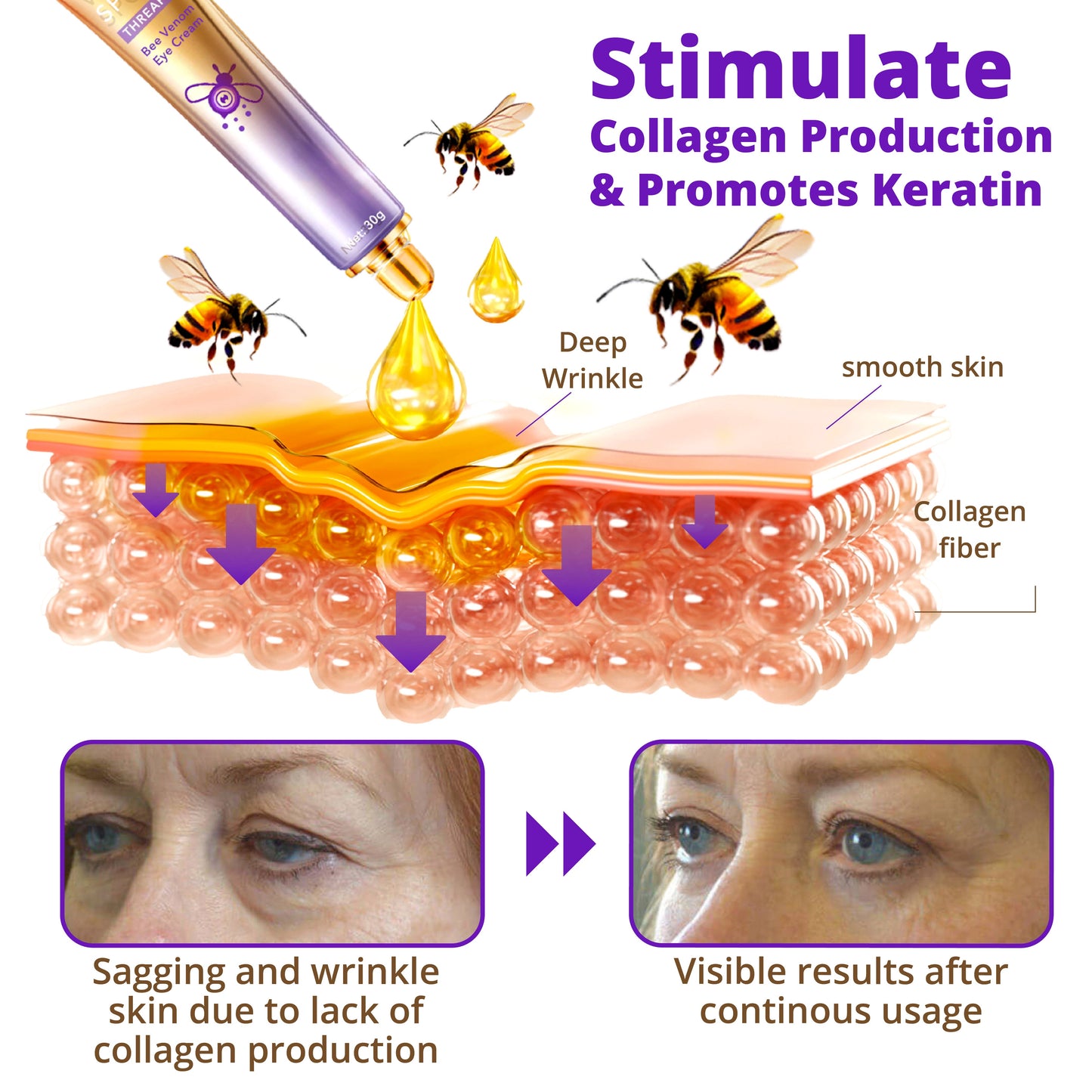 HZA™ WhiteSpots Threapy Bee Venom Eye Cream
